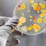 За полгода в Черновицкой области зарегистрировано три вспышки инфекционных болезней